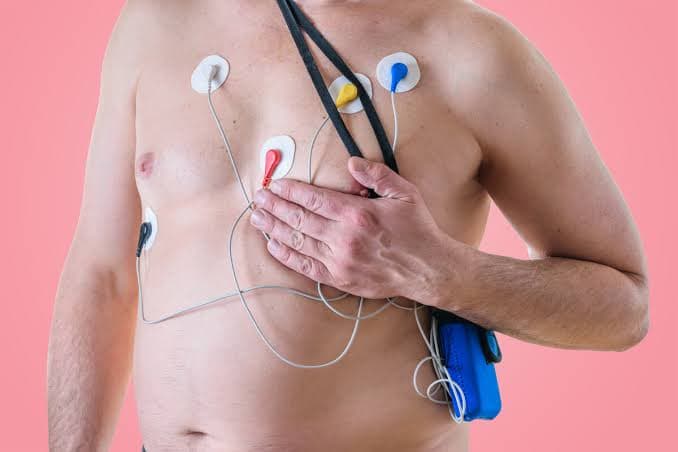 Holter EKG